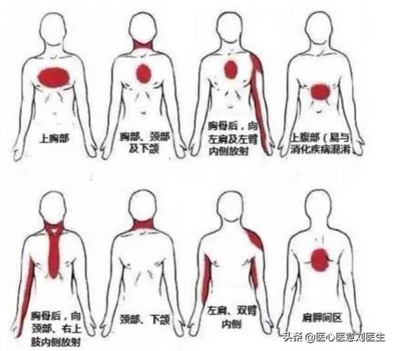 手臂位置疼是不是肺癌