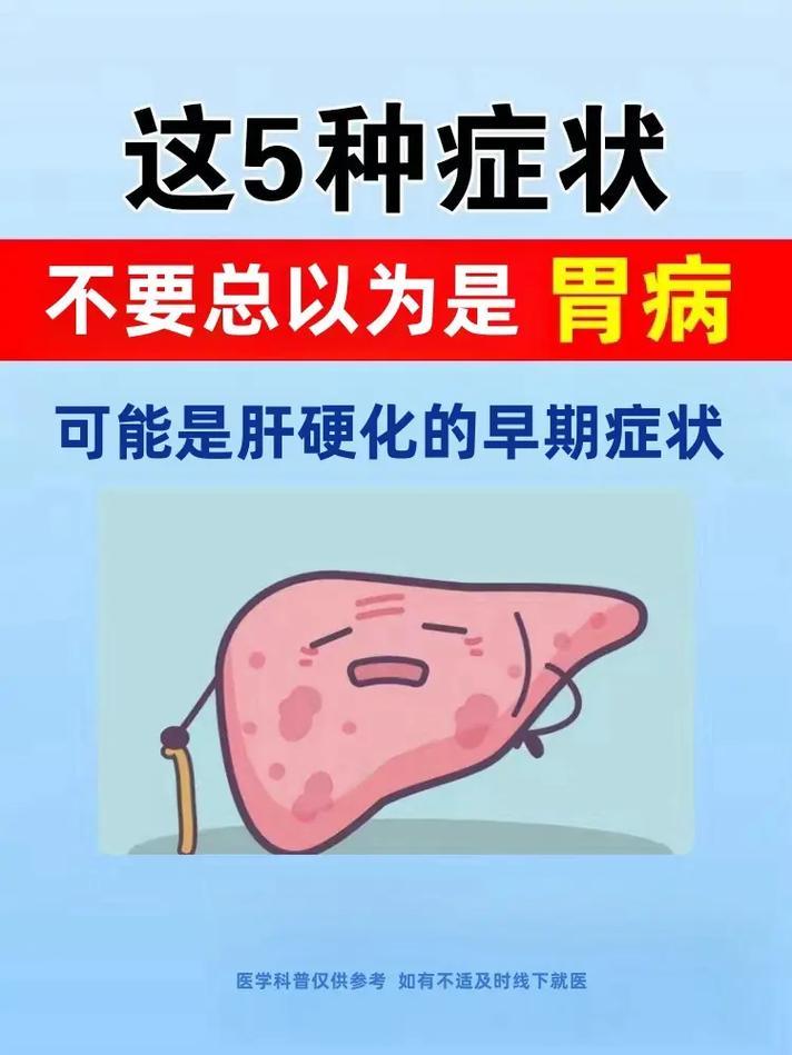 肝硬化的五大早期症状