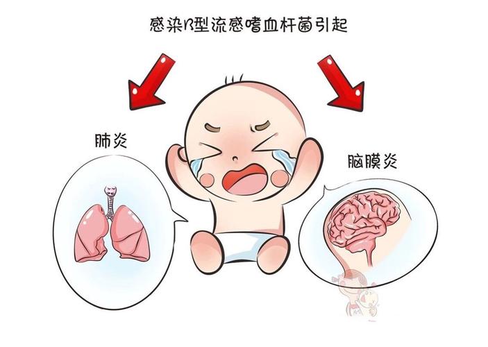 化脓性脑炎有什么症状