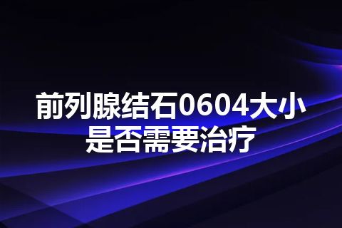 前列腺结石0604大小是否需要治疗