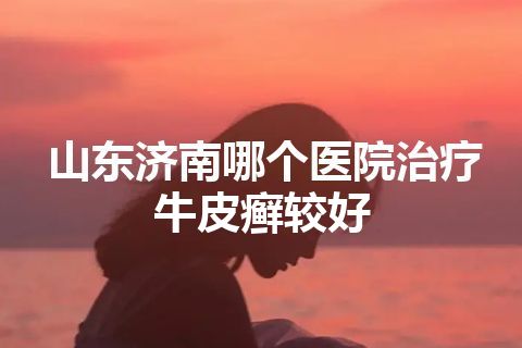 山东济南哪个医院治疗牛皮癣较好