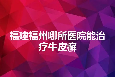 福建福州哪所医院能治疗牛皮癣