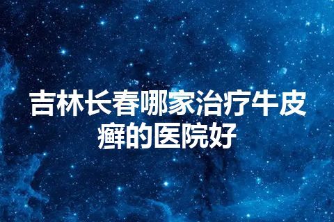 吉林长春哪家治疗牛皮癣的医院好