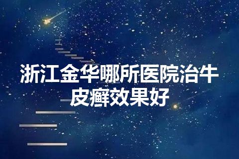 浙江金华哪所医院治牛皮癣效果好