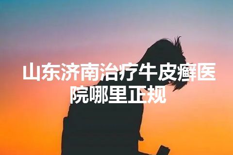 山东济南治疗牛皮癣医院哪里正规