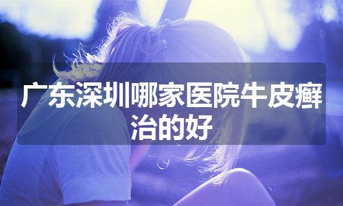 广东深圳哪家医院牛皮癣治的好