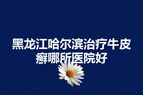 黑龙江哈尔滨治疗牛皮癣哪所医院好