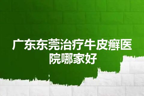 广东东莞治疗牛皮癣医院哪家好