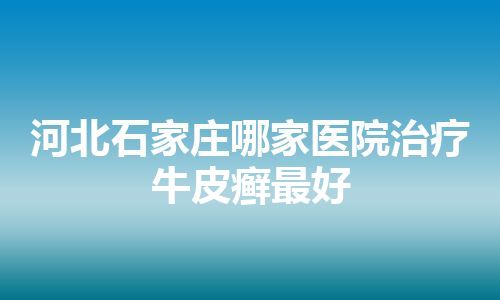 河北石家庄哪家医院治疗牛皮癣最好