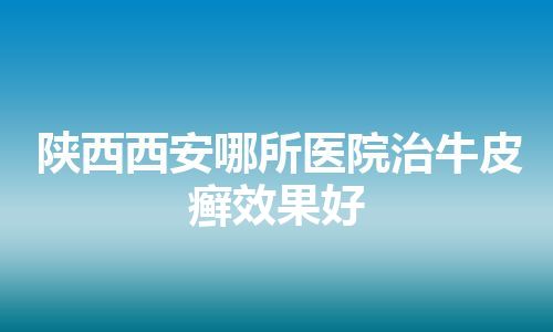 陕西西安哪所医院治牛皮癣效果好