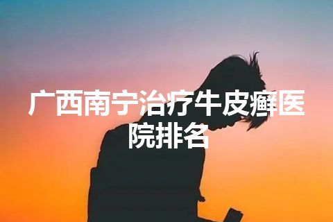 广西南宁治疗牛皮癣医院排名