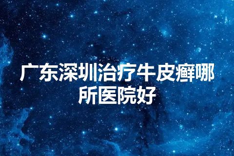 广东深圳治疗牛皮癣哪所医院好