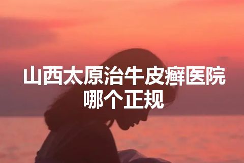 山西太原治牛皮癣医院哪个正规