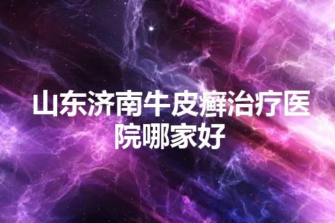 山东济南牛皮癣治疗医院哪家好