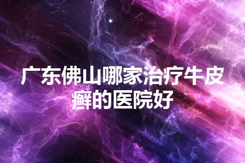 广东佛山哪家治疗牛皮癣的医院好