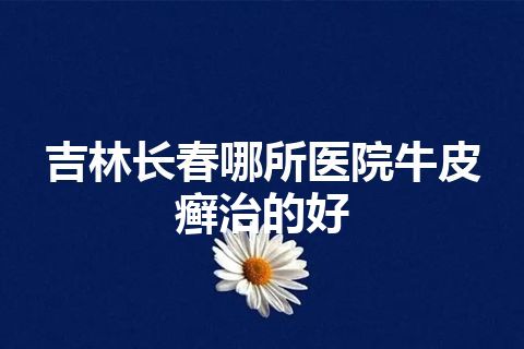 吉林长春哪所医院牛皮癣治的好