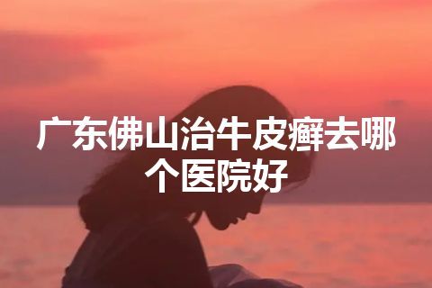 广东佛山治牛皮癣去哪个医院好