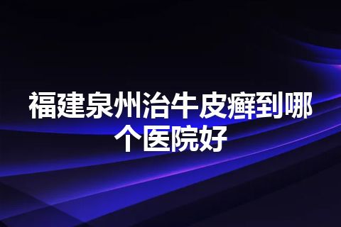 福建泉州治牛皮癣到哪个医院好