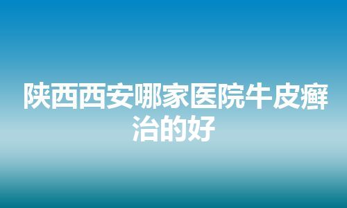 陕西西安哪家医院牛皮癣治的好