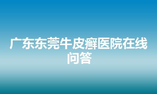 广东东莞牛皮癣医院在线问答