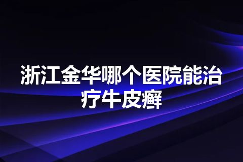 浙江金华哪个医院能治疗牛皮癣