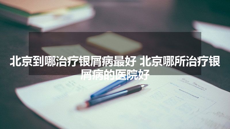 北京到哪治疗银屑病最好 北京哪所治疗银屑病的医院好