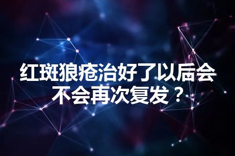 红斑狼疮治好了以后会不会再次复发？