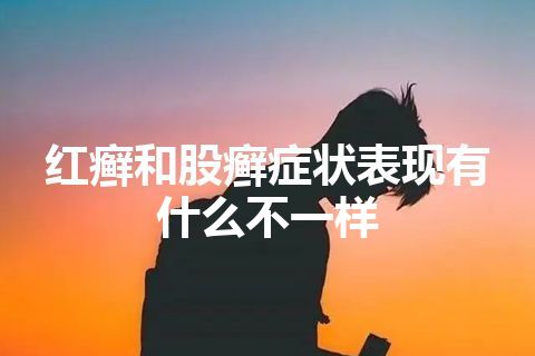 红癣和股癣症状表现有什么不一样