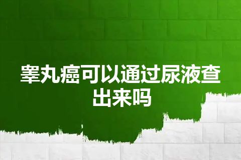 睾丸癌可以通过尿液查出来吗