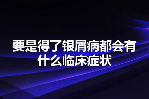 要是得了银屑病都会有什么临床症状