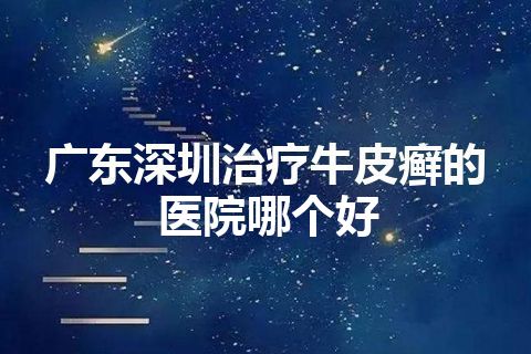 广东深圳治疗牛皮癣的医院哪个好