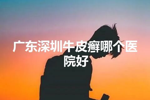 广东深圳牛皮癣哪个医院好