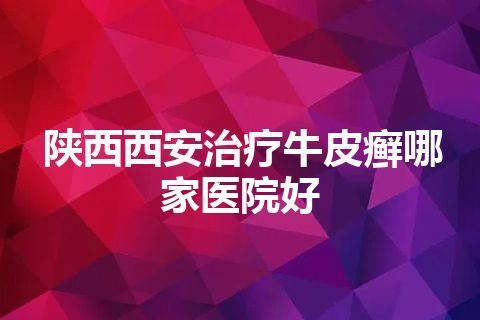 陕西西安治疗牛皮癣哪家医院好