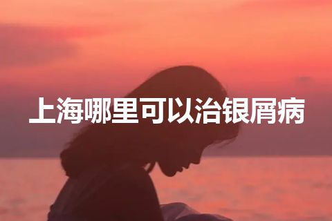 上海哪里可以治银屑病